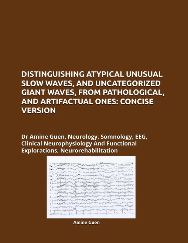 Distinguishing Atypical Slow Waves - Dr Amine Guen Book