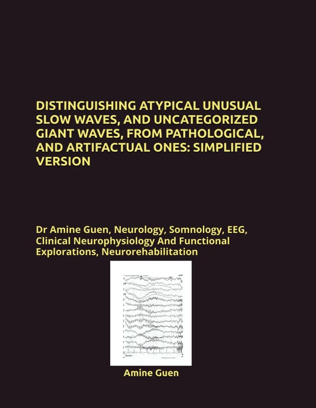 DISTINGUISHING ATYPICAL UNUSUAL SLOW WAVES, AND UNCATEGORIZED GIANT WAVES, FROM PATHOLOGICAL, AND ARTIFACTUAL ONES: SIMPLIFIED VERSION: Dr Amine Guen, ... Functional Explorations, Neurorehabilitation
