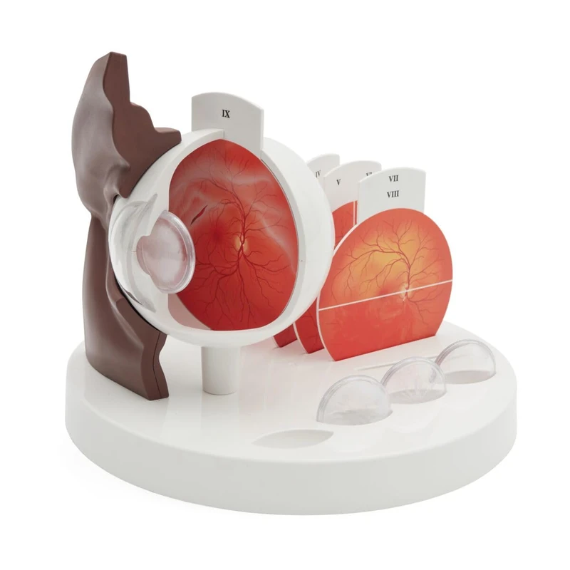 3B Scientific Pathological Human Eye Model, dark skin, 3B Smart Anatomy - Image 1