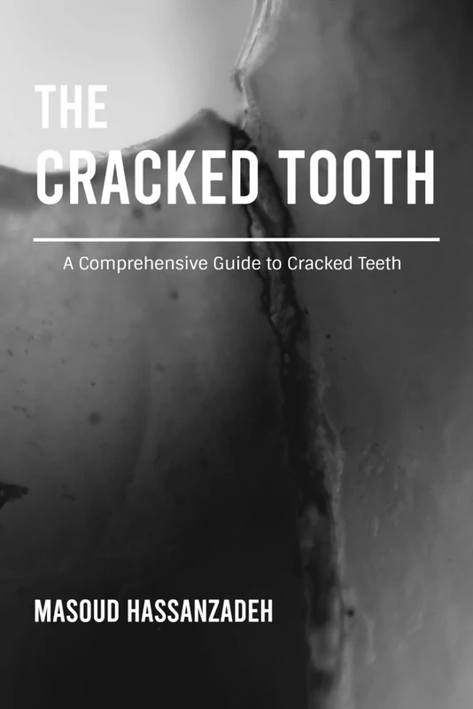 The Cracked Tooth: A Comprehensive Guide to Cracked Teeth - Image 1