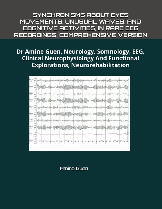 SYNCHRONISMS ABOUT EYES MOVEMENTS, UNUSUAL WAVES, AND COGNITIVE ACTIVITIES, IN RARE EEG RECORDINGS: COMPREHENSIVE VERSION: Dr Amine Guen, Neurology, ... Functional Explorations, Neurorehabilitation