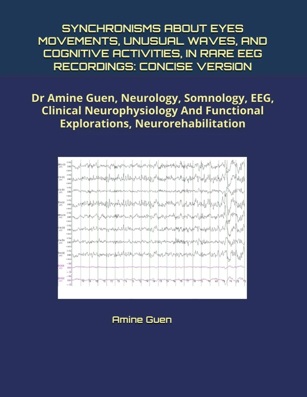 Synchronisms About Eyes Movements and EEG Recordings - Dr Amine Guen