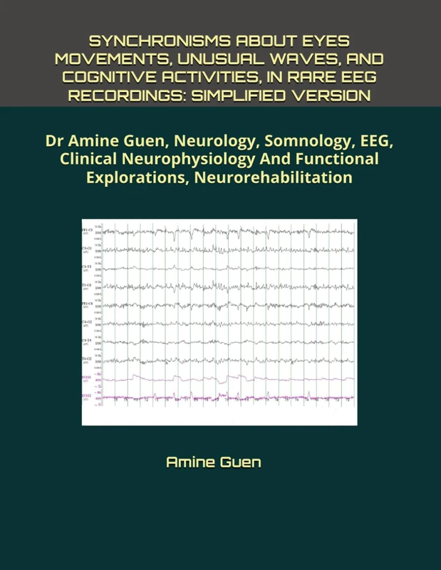 Synchronisms About Eyes Movements and EEG Recordings - Dr Amine Guen