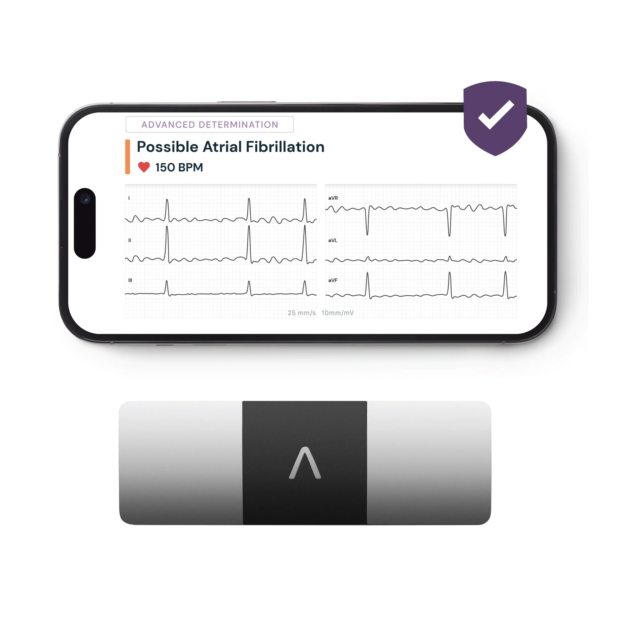 KardiaMobile 6-Lead Personal ECG Heart Rate Monitor + 1 Month Free of KardiaCare - Six Views of The Heart, Detects Atrial Fibrillation, Trusted by The NHS, Fast Results, Works with Most Smartphones