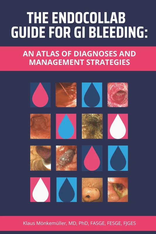 The EndoCollab Guide for GI Bleeding: An Atlas of Diagnoses and Management Strategies