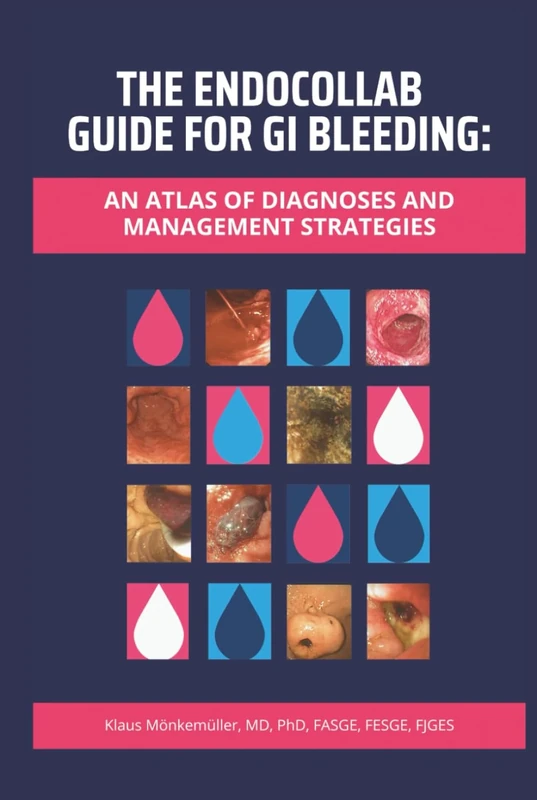 The EndoCollab Guide for GI Bleeding: An Atlas of Diagnoses and Management Strategies
