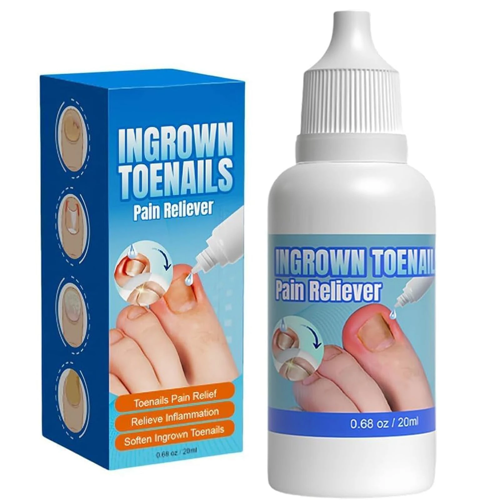 Ingrown Toenail Treatments, Ingrown Nail Treatment for Toenails Extra-Strong, Ingrowning Toenail Treatment, 20ml