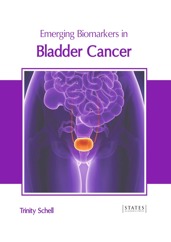 Emerging Biomarkers in Bladder Cancer