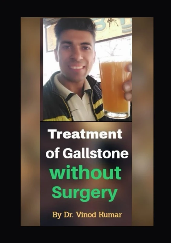 Treatment of Gallstone without Surgery: Heal Your Gallbladder Naturally – A Complete Non-Surgical Guide