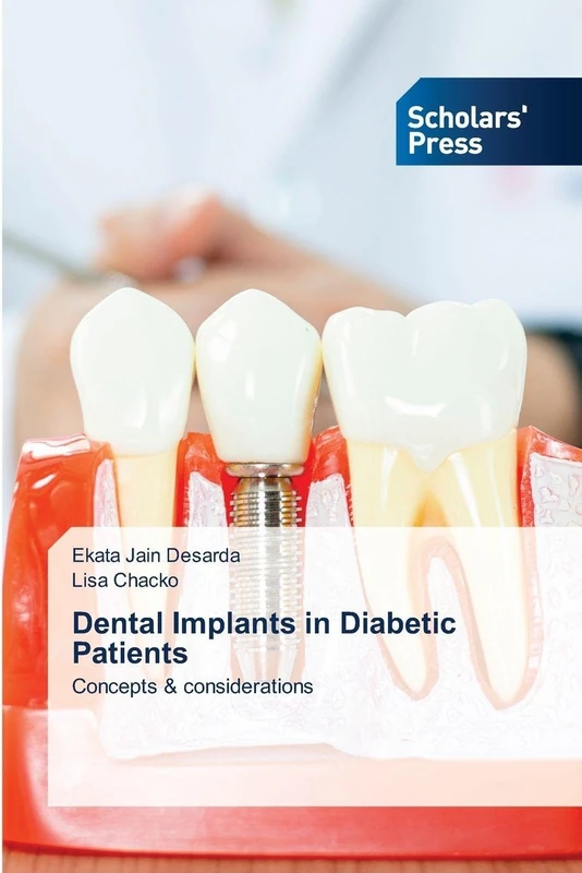 Dental Implants in Diabetic Patients: Concepts & considerations