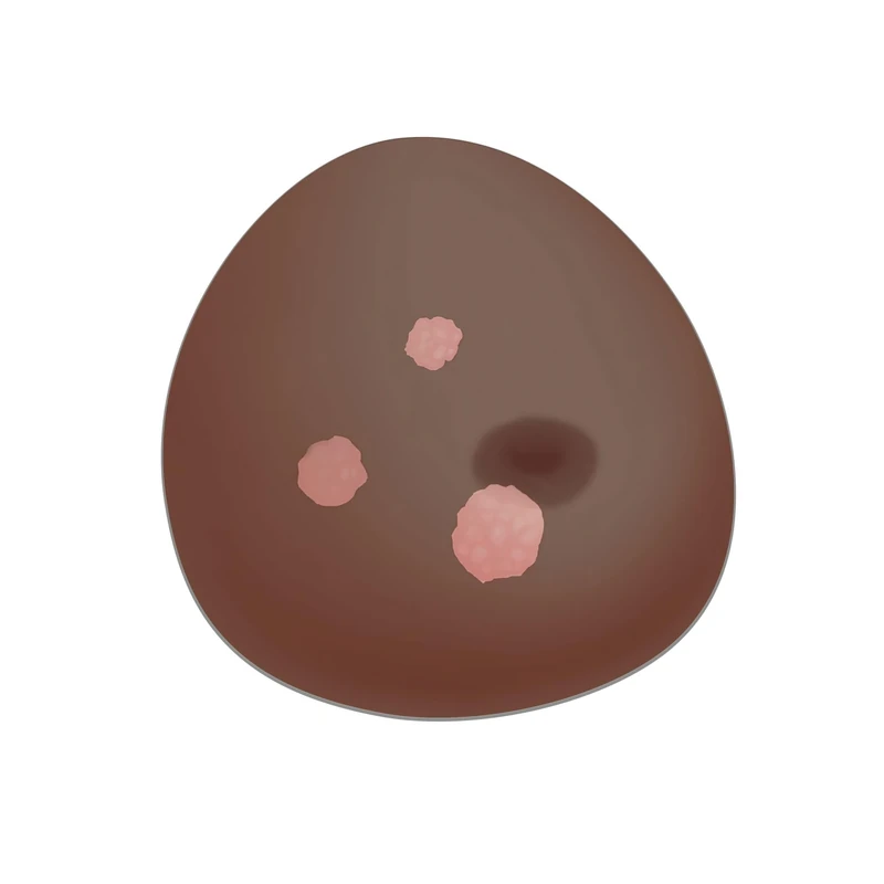 3B Scientific® Sonotrain Breast Model with Cysts – Dark Skin Ultrasound Breast Simulator for Cyst Detection & Diagnostic Training