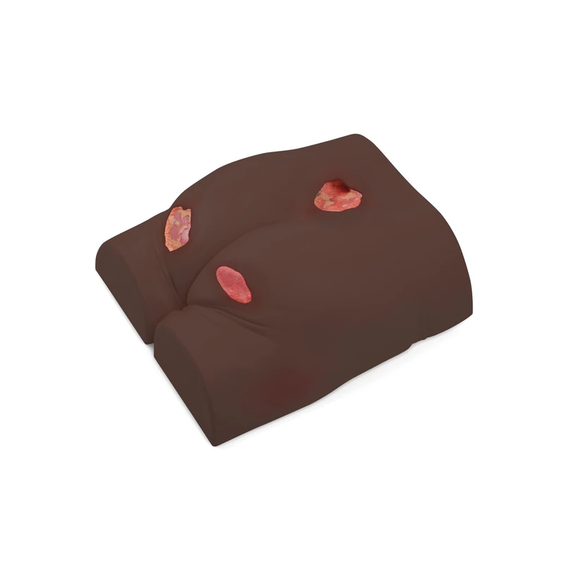 3B Scientific Decubitus Trainer - Dark Skin Buttocks Model