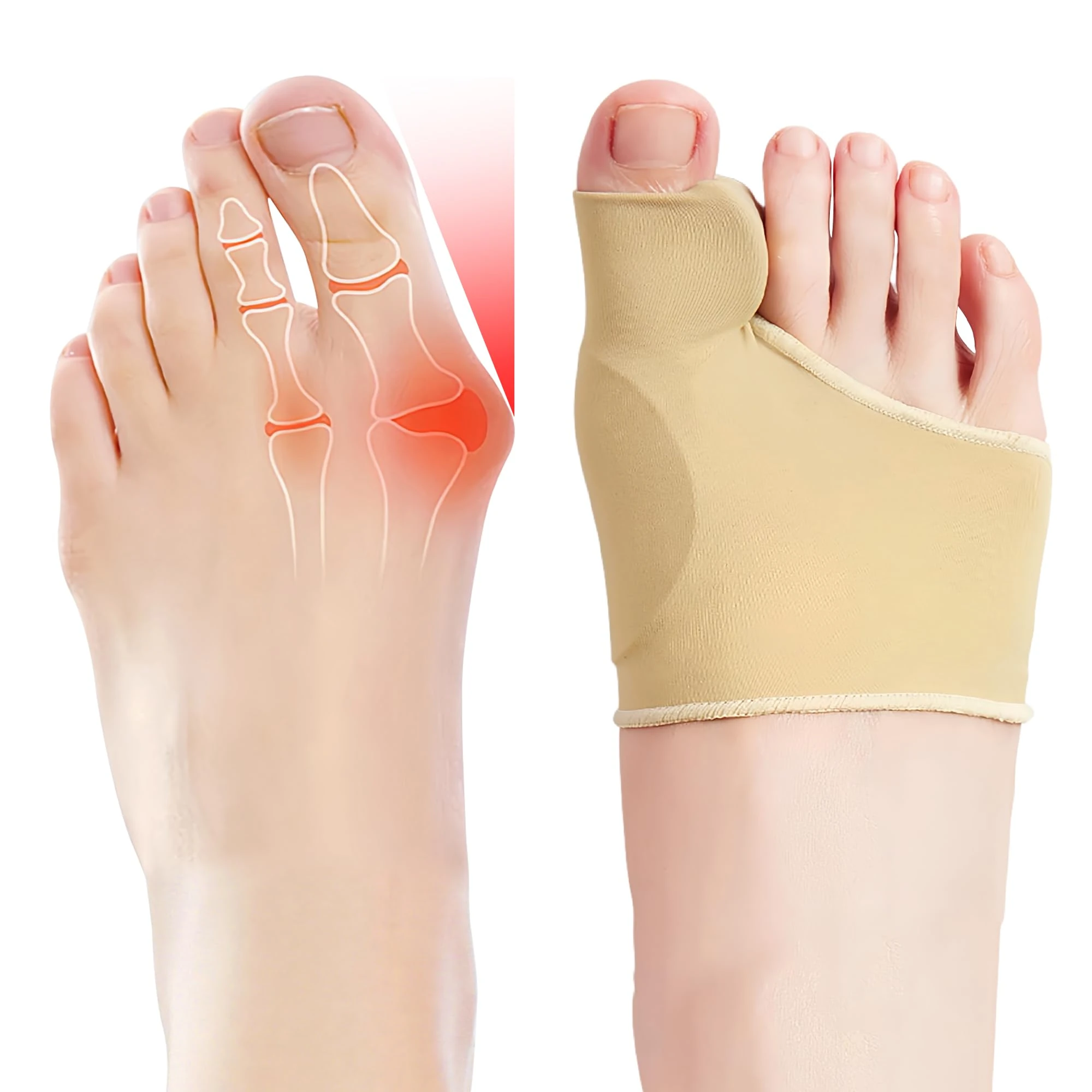 EASICUTI 2 Pairs Bunion Corrector, Big Toe Separators Gel Pads Support for Hallux Valgus Correction Big Toe Straightener Protector Bunion Pain Relief, Toe Spacers for Men & Women Day Night Wear, Beige