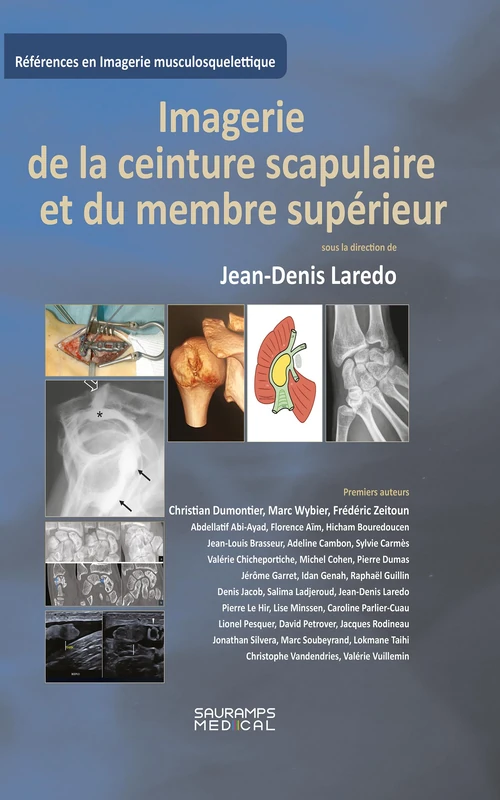Imagerie de la ceinture scapulaire et du membre supérieur