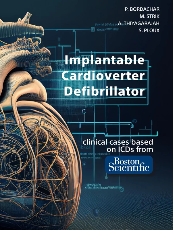 Implantable Cardioverter Defibrillator: based on clinical cases from Boston Scientific ICDs [FULL COLOR]