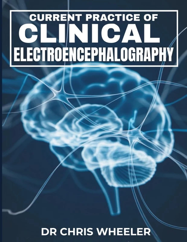 CURRENT PRACTICE OF CLINICAL ELECTROENCEPHALOGRAPHY: Comprehensive Insights into Diagnostic Techniques, Treatment Strategies, and Emerging Trends in Neurophysiology.