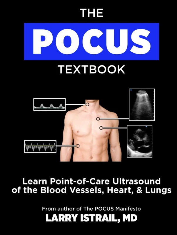 The POCUS Textbook: Learn Point-of-Care Ultrasound of the Blood Vessels, Heart, & Lungs