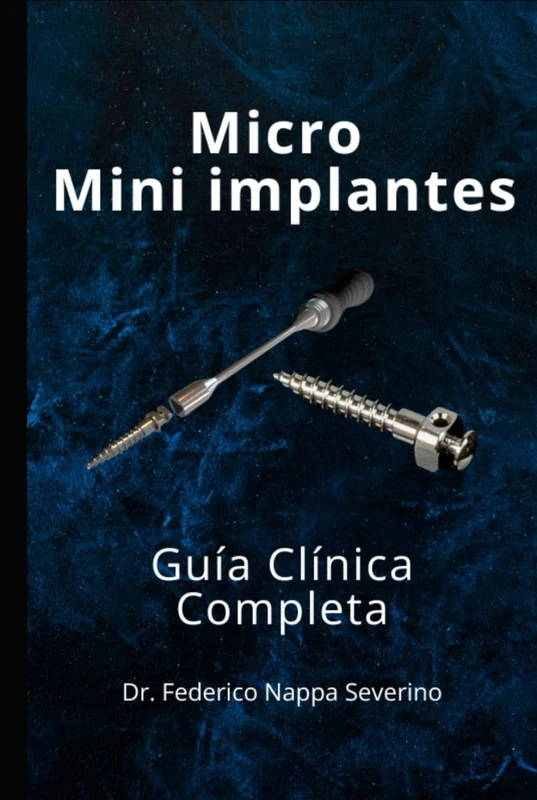 Guía Clínica de Micro y Mini Implantes en Ortodoncia: Diagnóstico, planificación y aplicación clínica paso a paso - Image 1