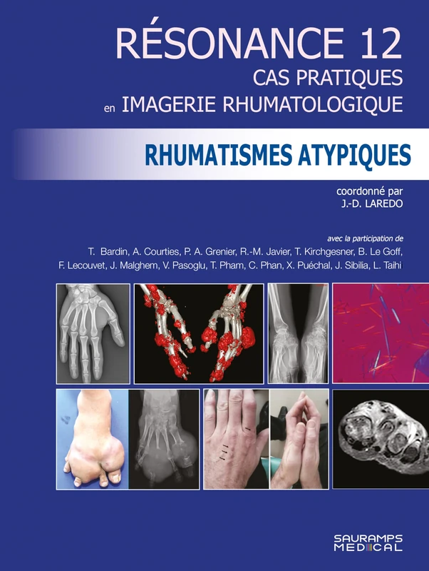 Résonance 12 - Rhumatismes atypiques: Cas pratiques en imagerie rhumatologique