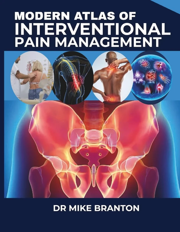 Modern Atlas Of Interventional Pain Management: A Step-by-Step Guide to 200+ Evidence-Based Procedures with Advanced Imaging Techniques.