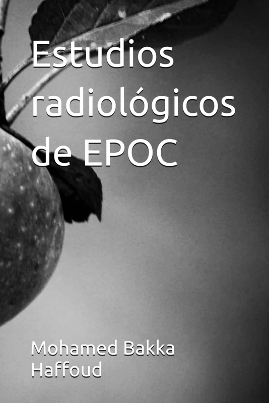 Estudios radiológicos de EPOC