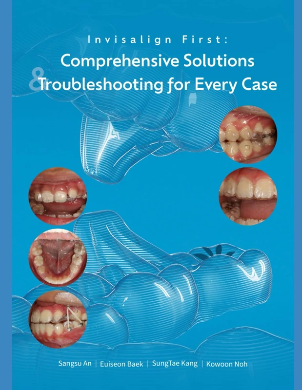 Invisalign First Comprehensive solutions and Trouble shooting for every case: A Step-by-Step Guide to Mixed-Dentition Clear Aligners, Digital Planning and Clinical Troubleshooting Invisalign first - Image 1