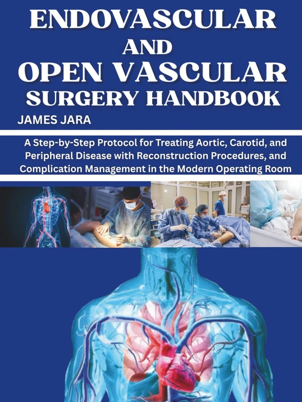 Endovascular and Open Vascular Surgery Handbook - Practical Guide