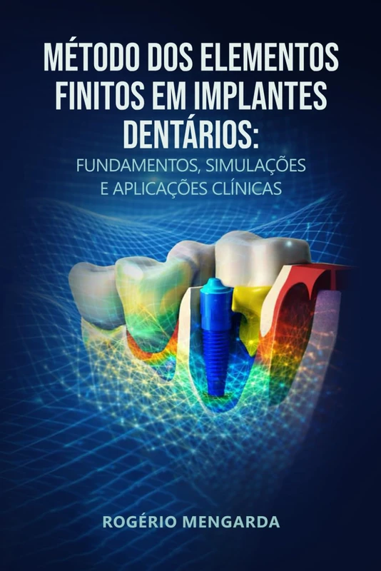 MÉTODO DOS ELEMENTOS FINITOS EM IMPLANTES DENTÁRIOS: FUNDAMENTOS, SIMULAÇÕES E APLICAÇÕES CLÍNICASMÉTODO DOS ELEMENTOS FINITOS EM IMPLANTES DENTÁRIOS - Image 1