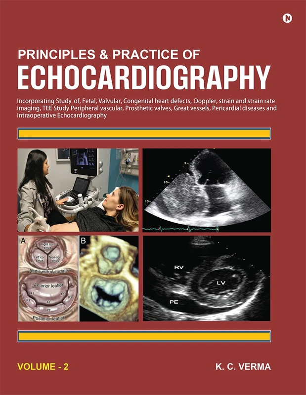 Principles and Practice of Echocardiography Volume 2