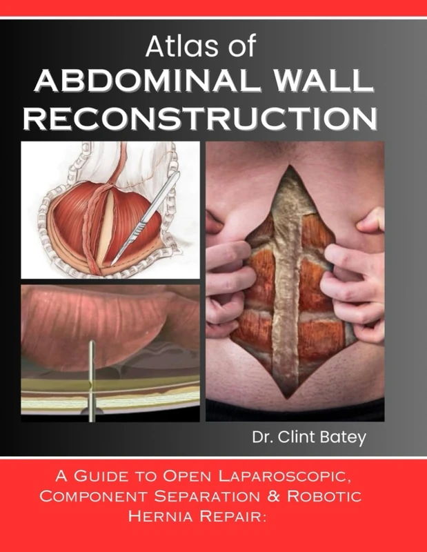 ATLAS OF ABDOMINAL WALL RECONSTRUCTION: A Guide to Open Laparoscopic, Component Separation & Robotic Hernia Repair: