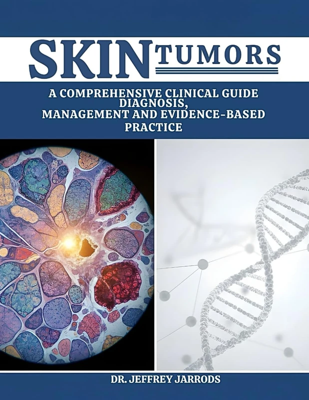 Skin Tumors: A Comprehensive Clinical Guide Diagnosis, Management, And Evidence Based Practice.