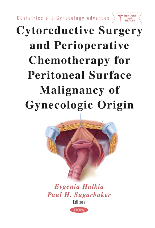 Cytoreductive Surgery and Perioperative Chemotherapy Book - Image 1