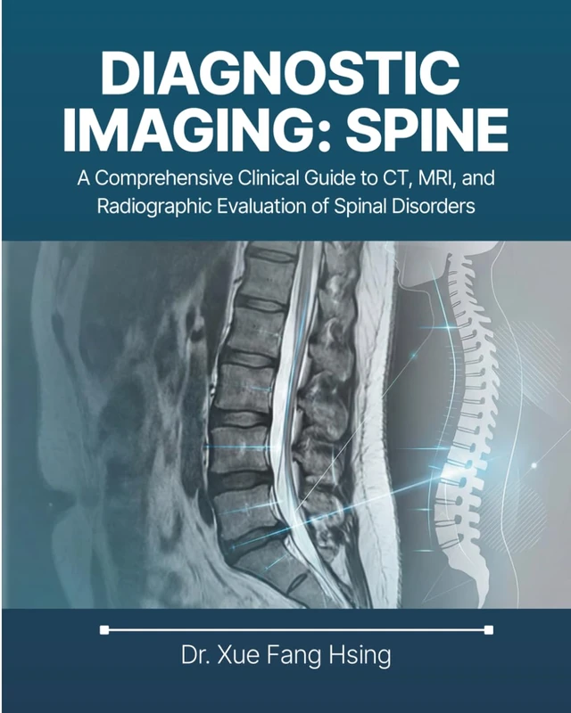 Diagnostic Imaging: Spine: A Comprehensive Clinical Guide to CT, MRI, and Radiographic Evaluation of Spinal Disorders