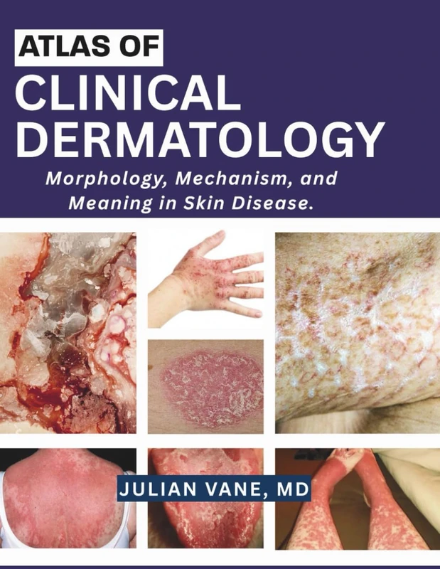 ATLAS OF CLINICAL DERMATOLOGY: Morphology, Mechanism, and Meaning in Skin Disease.