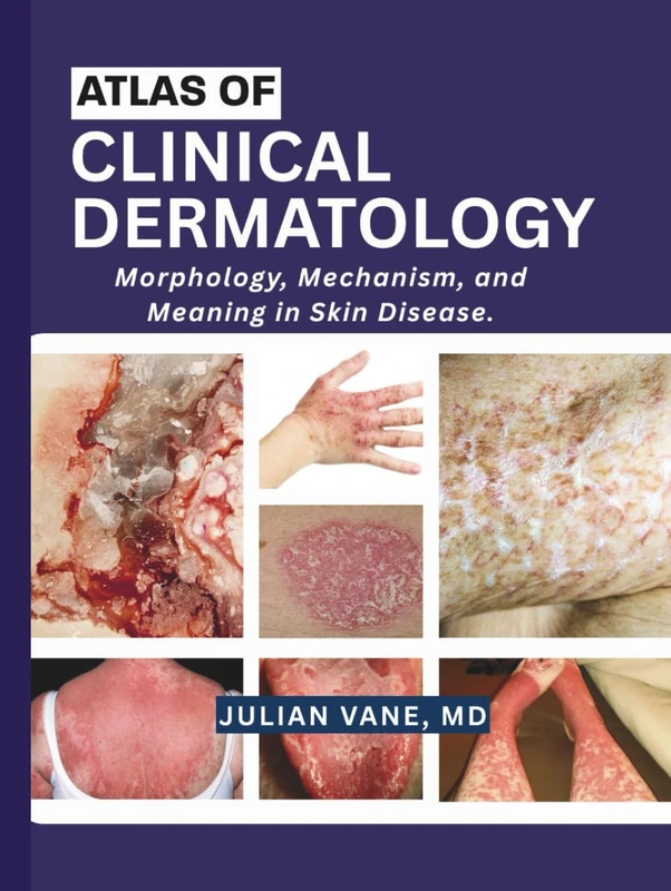 ATLAS OF CLINICAL DERMATOLOGY: Morphology, Mechanism, and Meaning in Skin Disease.