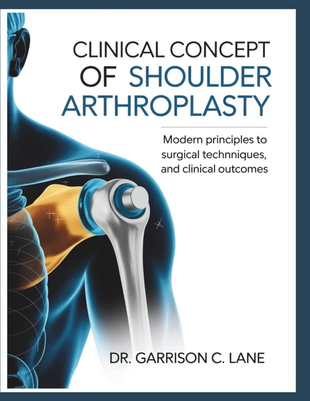 Clinical Concept of Shoulder Arthroplasty - Medical Textbook