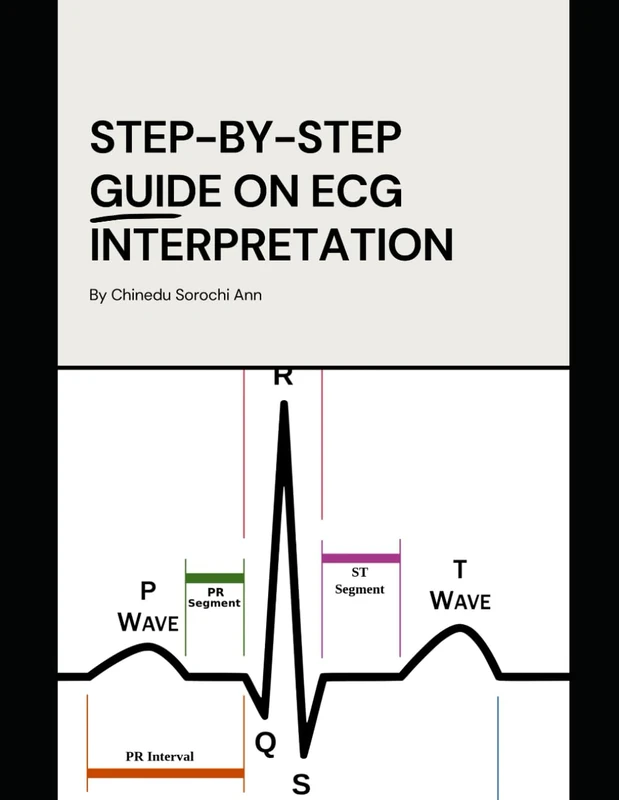 Step-By-Step Guide On ECG Interpretation: A Simplified Step-by-Step Clinical Guide to ECG Interpretation and Cardiovascular Drug Management