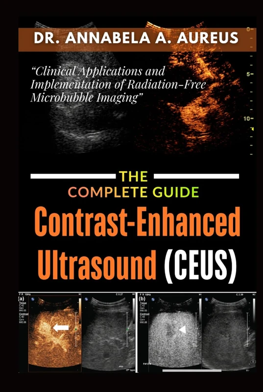 Contrast-Enhanced Ultrasound (CEUS): The Complete Guide: Clinical Applications and Implementation of Radiation-Free Microbubble Imaging (The Ultrasound Mastery Series)