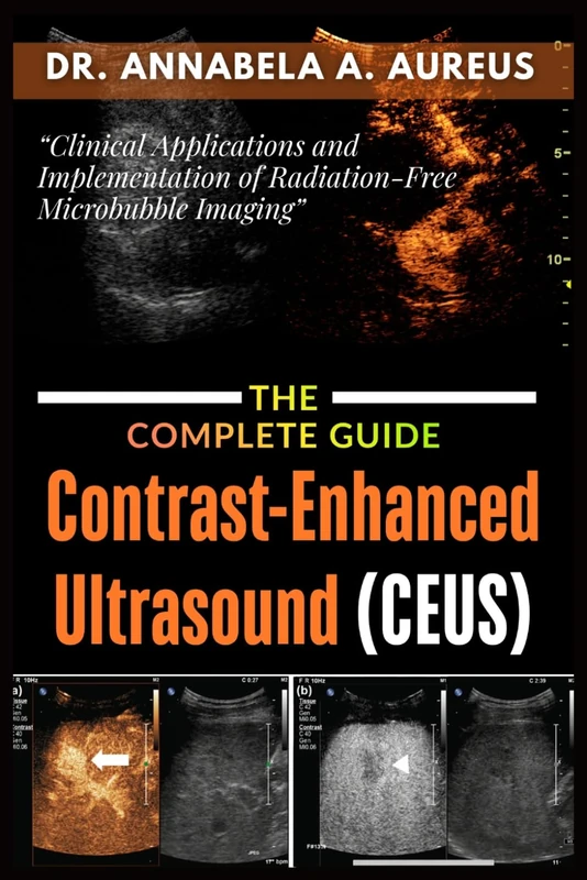 Contrast-Enhanced Ultrasound (CEUS): The Complete Guide: Clinical Applications and Implementation of Radiation-Free Microbubble Imaging (The Ultrasound Mastery Series)