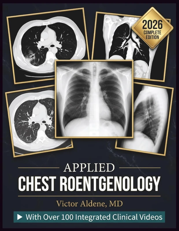 APPLIED CHEST ROENTGENOLOGY: A Systematic Guide to Image Interpretation, Differential Diagnosis, and Clinical Decision-Making