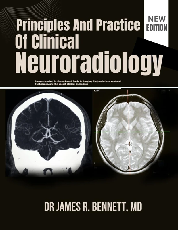 Principles And Practice Of Clinical Neuroradiology: Comprehensive, Evidence-Based Guide to Imaging Diagnosis, Interventional Techniques, and the Latest Clinical Guidelines
