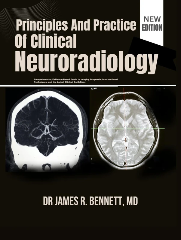Principles And Practice Of Clinical Neuroradiology: Comprehensive, Evidence-Based Guide to Imaging Diagnosis, Interventional Techniques, and the Latest Clinical Guidelines