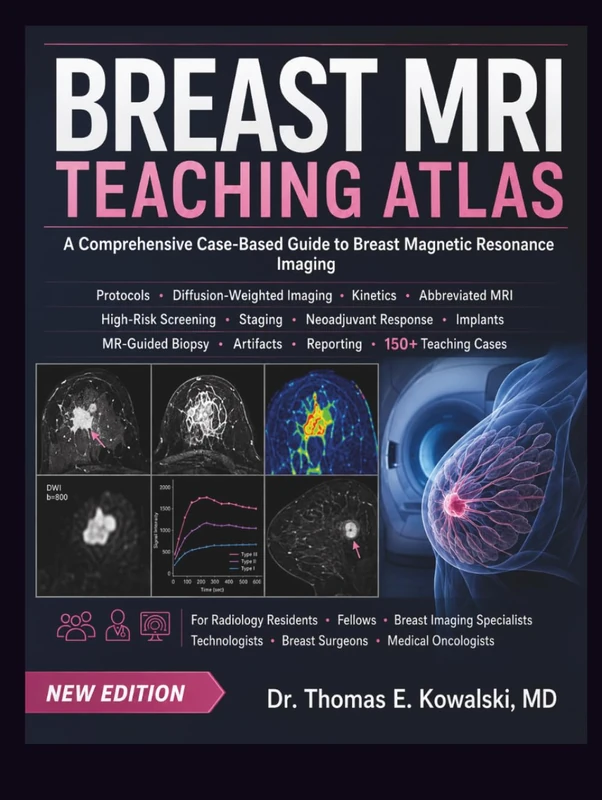 BREAST MRI TEACHING ATLAS: A Comprehensive Case-Based Guide to Breast Magnetic Resonance Imaging